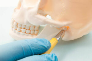Гнатологія: важлива галузь стоматології для корекції прикусу та поліпшення стану ротової порожнини